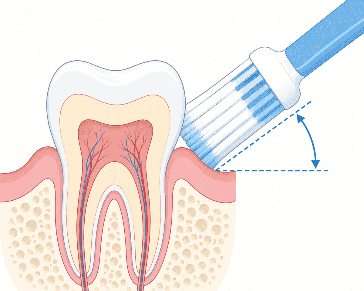 Toothbrush held at a 45-degree angle against the gumline, showing correct bristle contact at the tooth-gum junction